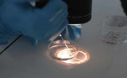 子宫内膜炎会引起出血吗