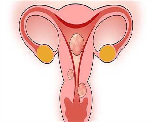 生殖代生服务移植怀孕nt是什么原因，移植囊胚nt都正常吗