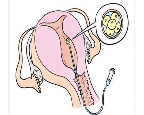 试管156天费用明细