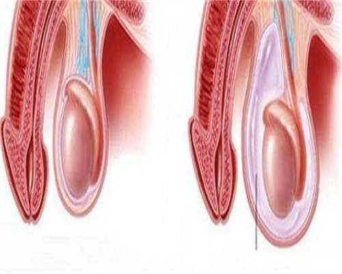 福州靠谱代孕案例,
              福州市中医院做试管婴儿生孩子一次需要准备多