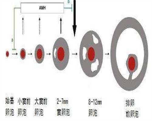 海南助孕妈妈招聘，不育夫妻实现生育梦的胜利之光
