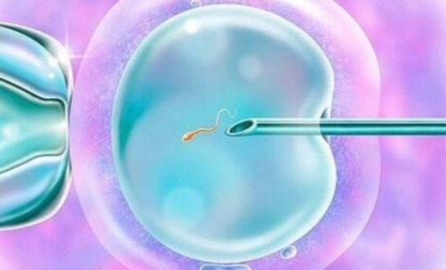 江门允许做试管婴儿,试管婴儿过程!