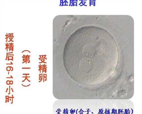 江门巧克力囊肿影响试管婴儿成功率吗?试管价格一览!