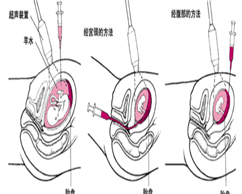 二代代生服务公司c级精子能与卵子受精吗？